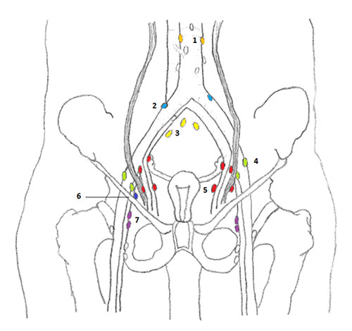Illustration of a woman's pelvic area showing the lymph nodes numbered 1 through 7.