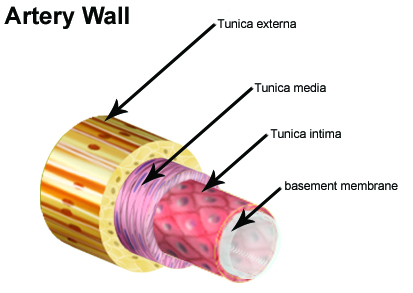 Illustration on an artery wall